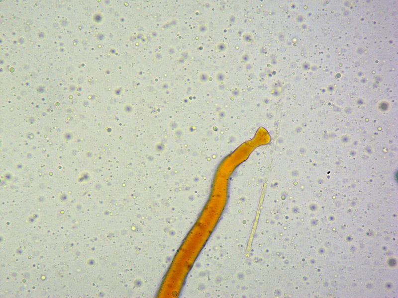 Phylloscypha-phyllogena-14-Aschi-melzer-400x.jpg