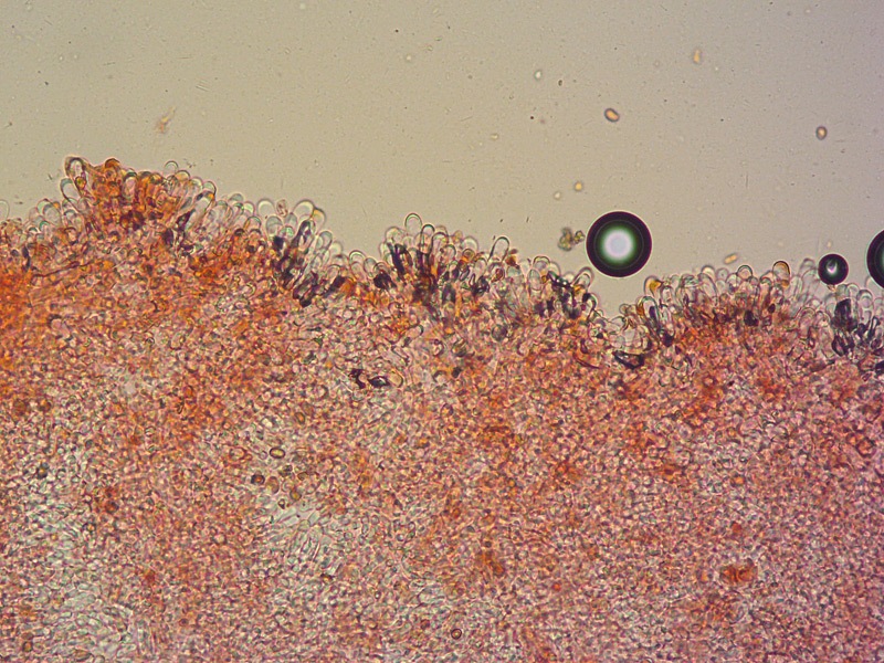 Agaricus-bisporus-07-Cheilo-RC-200x.jpg