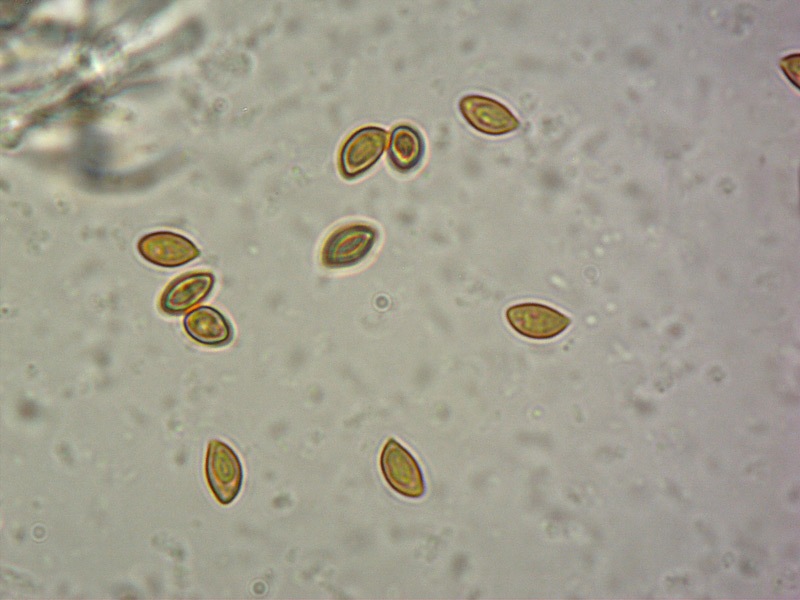 Cortinarius-claricolor-15-Spore-KOH-1000x.jpg