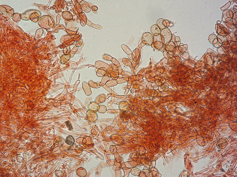 Cysstodermella-terryi-10-Pileipellis-RC-200x.jpg