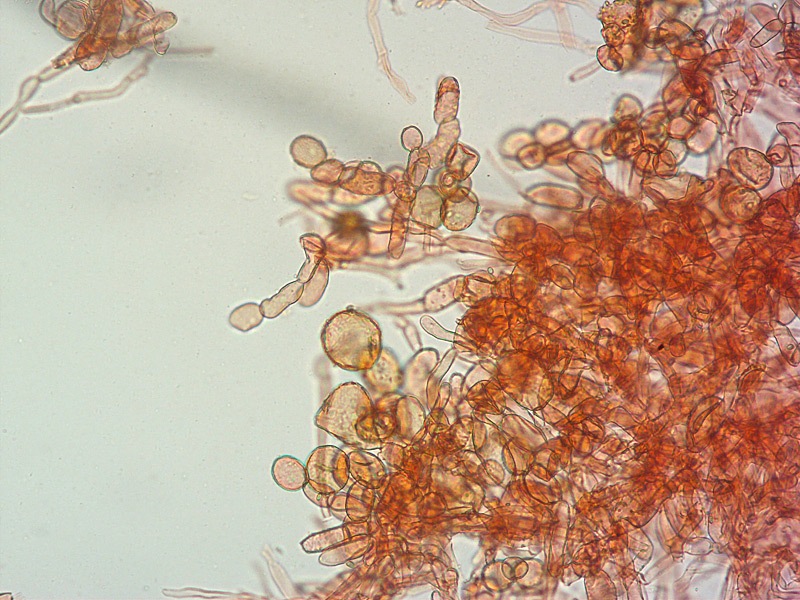 Cysstodermella-terryi-13-Pileipellis-RC-200x.jpg