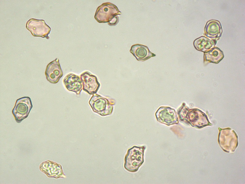Entoloma-aranense-24-31-Spore-RC-1000x.jpg