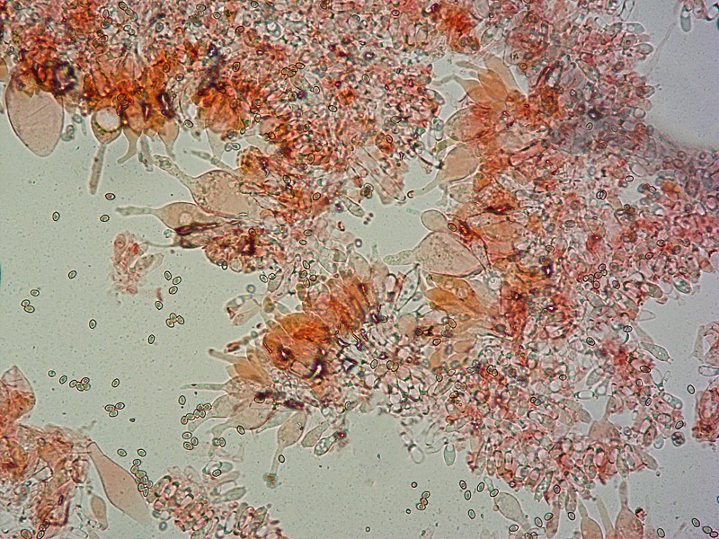Volvariella-caesiotincta-13-Cheilo-RC-200x.jpg