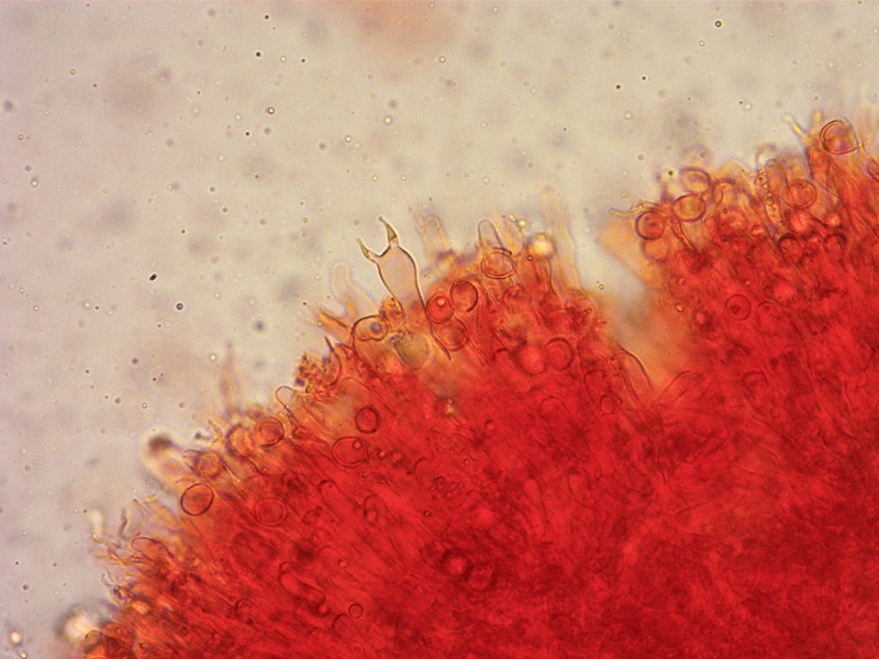 Clavulina-rugosa-03-Basidio-bisp-RC-400x.jpg