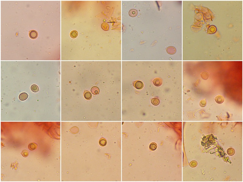 Clavulina-rugosa-09-17-Spore-RC-400x.jpg