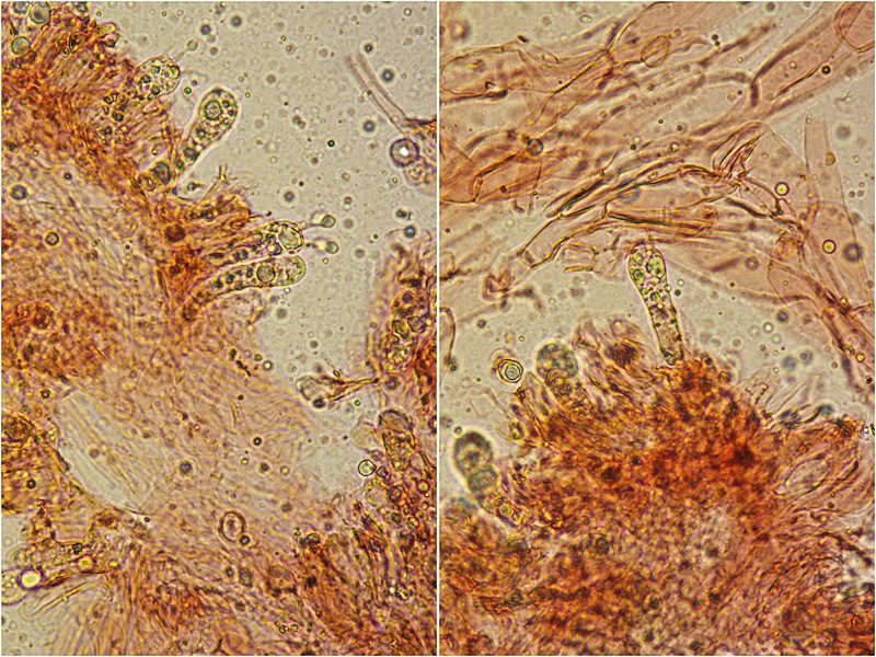 Lyophyllum-deliberatum-=-infumatum-03-4-Basidi-RC-400x.jpg
