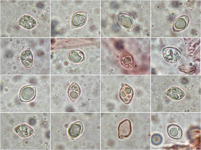 Lyophyllum-deliberatum-=-infumatum-26-38-deliberatum-=-infumatumore-RC-1000x.jpg