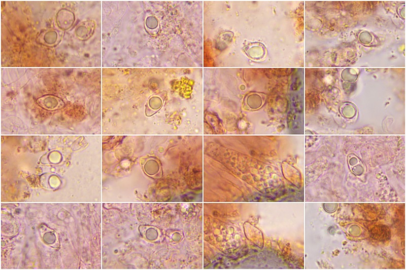 Lyophyllum-deliberatum-=-Lyophyllum-infumatum-05-14-Spore-1000×-RC-©-LM.jpg