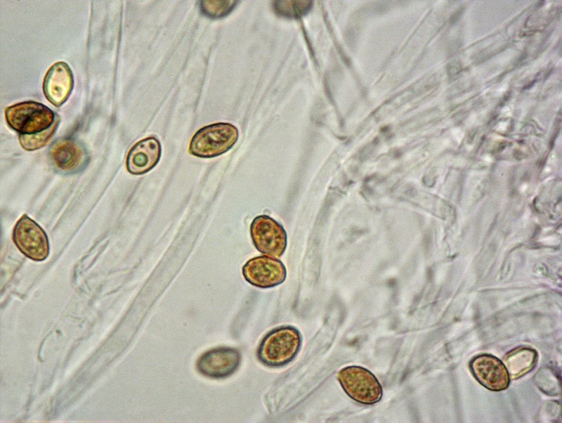 Cortinarius-armeniacus=poecilopus-A-16-8-TL250905-11-Spore-KOH-1000x-TL.jpg
