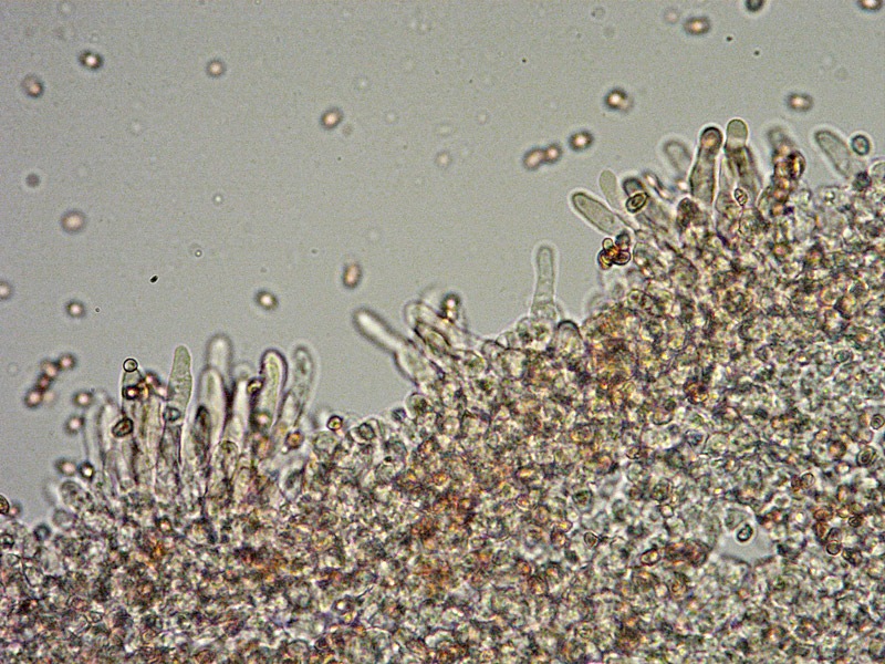 Leucoagaricus rhodelephantins-29-Cheilo-400x-RC.jpg